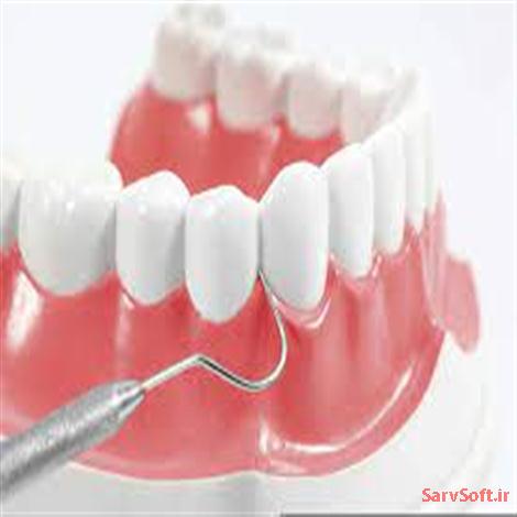 دانلود نمودارهای یوزکیس یا موردکاربرد دندانپزشکی با رشنال رز